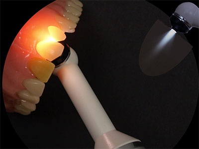 caries detect
