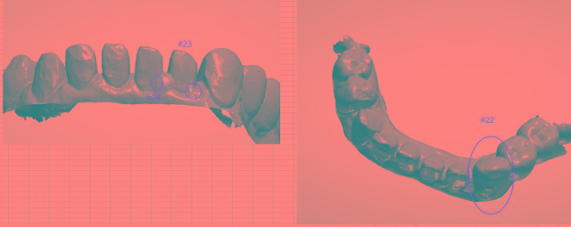 3D model