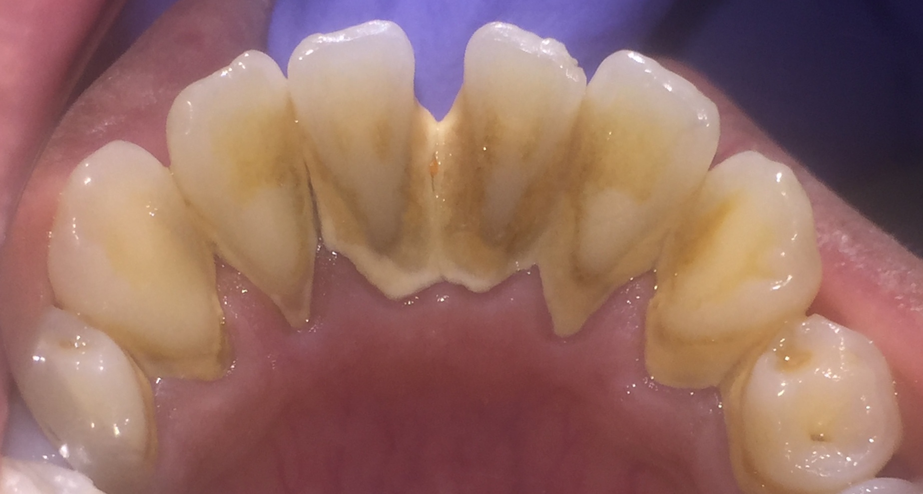 One Arch Deep Cleaning