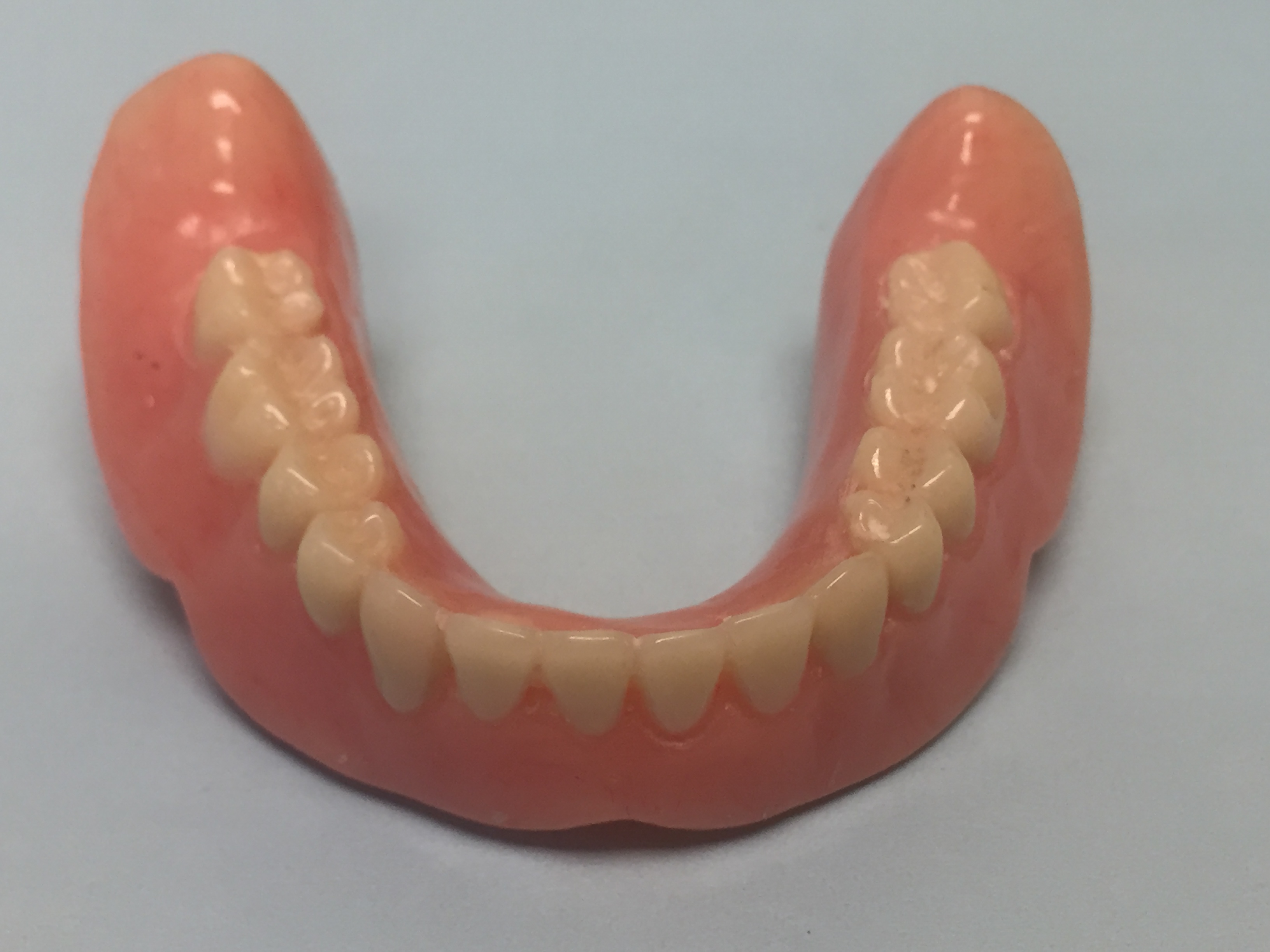 Mandibular Denture
