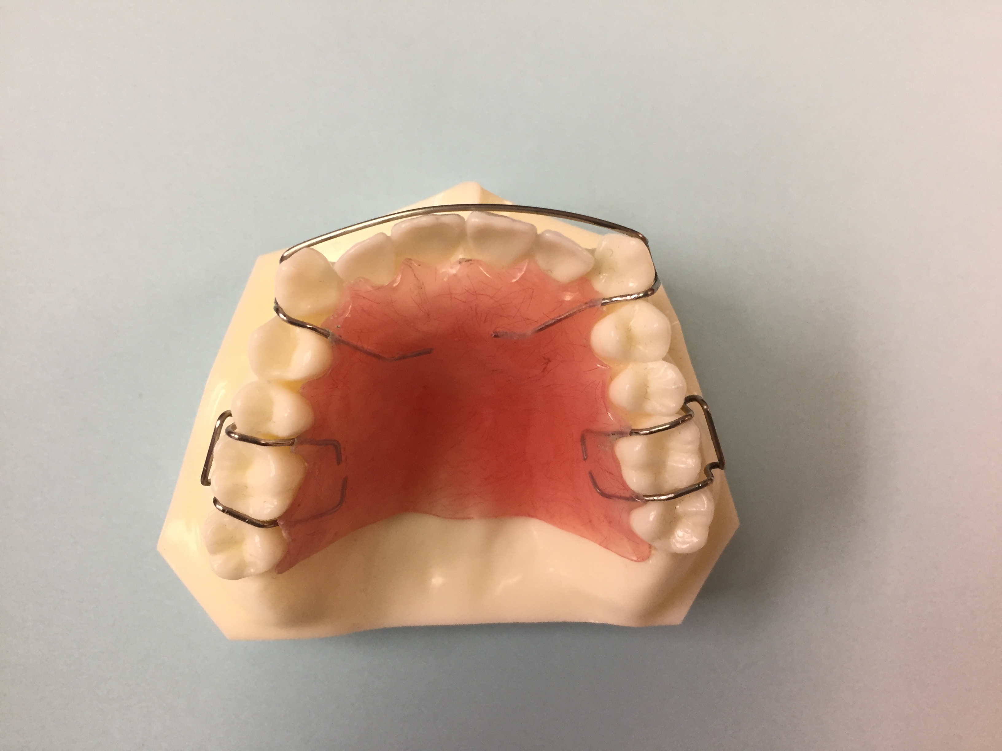 Hawley Orthodontic Retainer