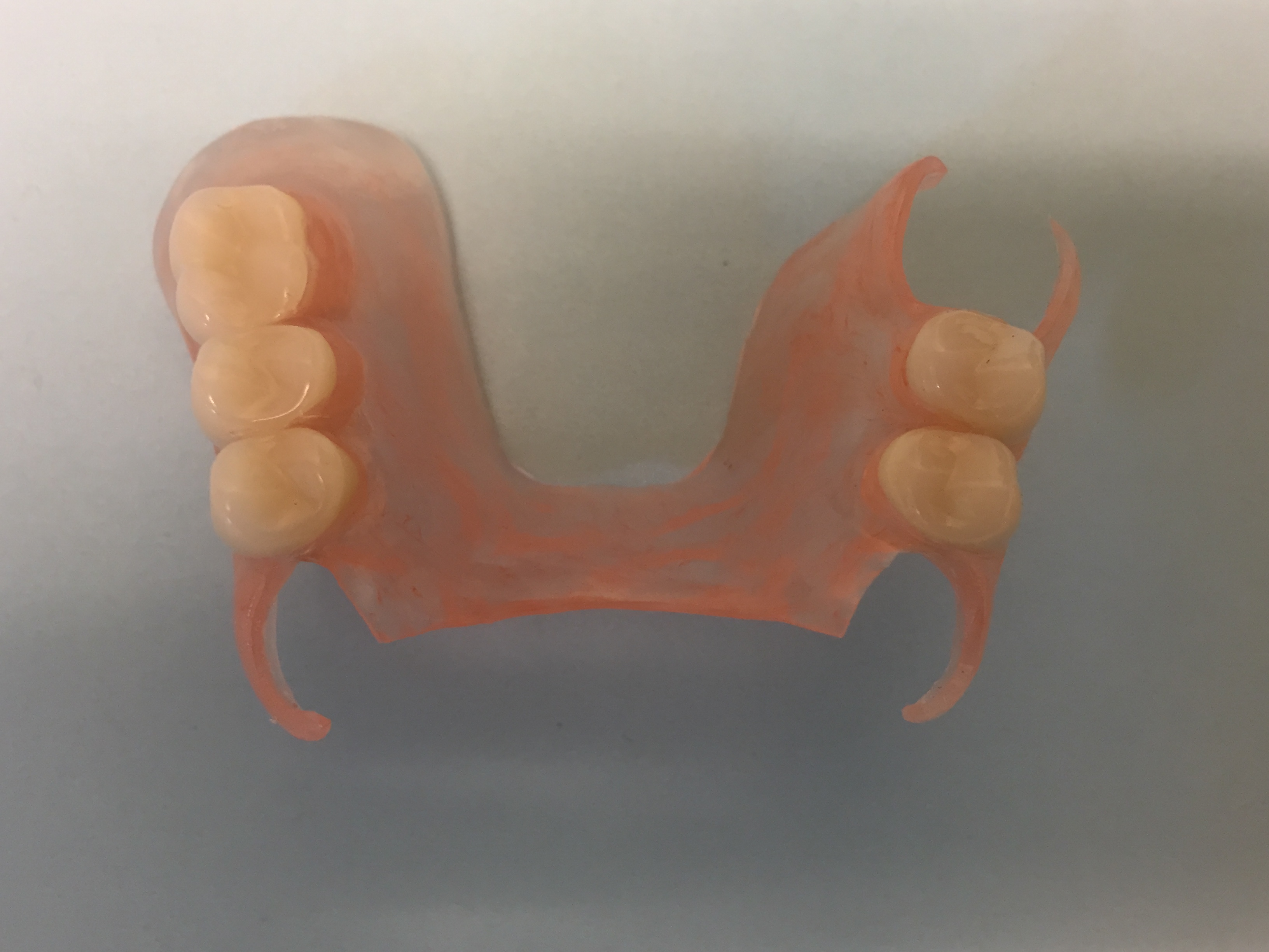 Acrylic Partial Denture