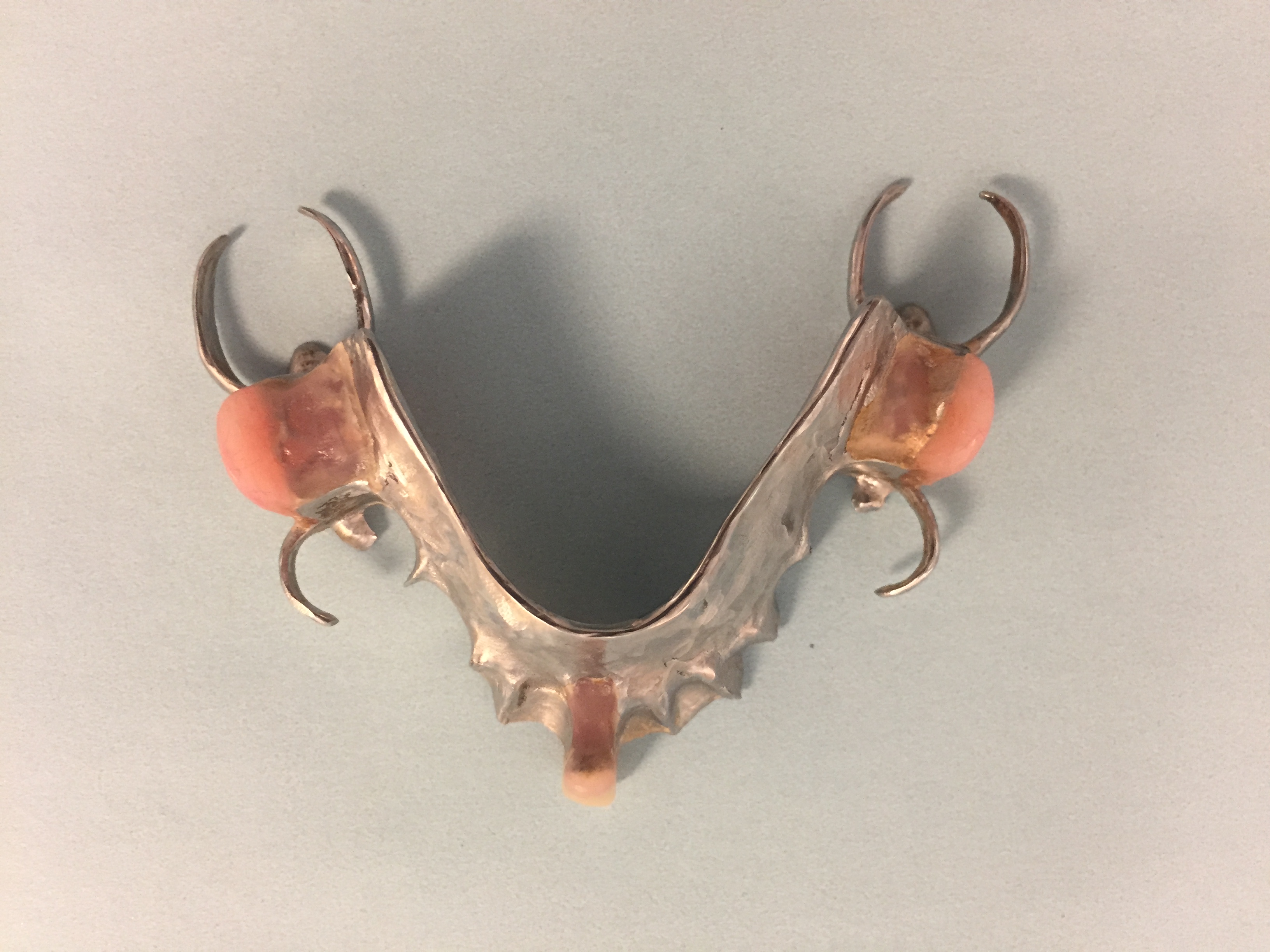 Metal Framework Partial Denture