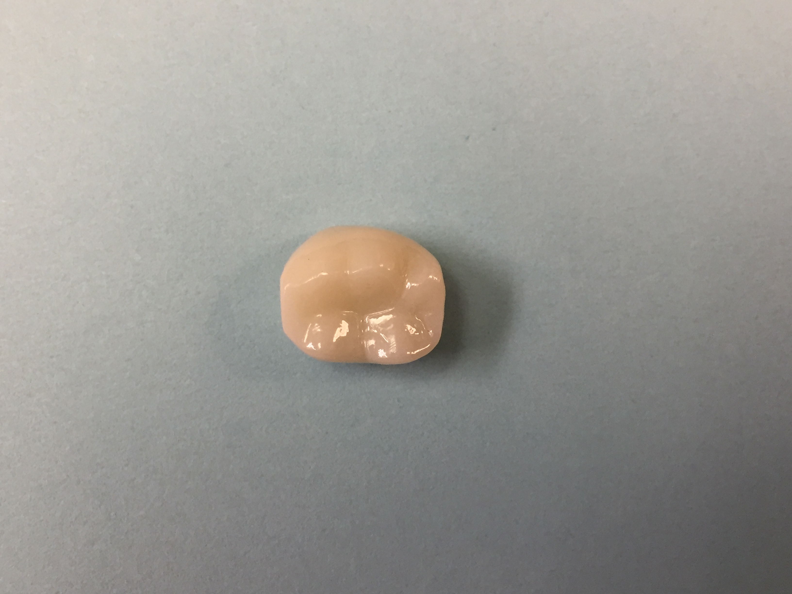 Zirconia Crowns