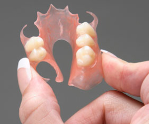 Flexible Partial Denture