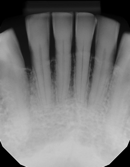 Lower Radiograph