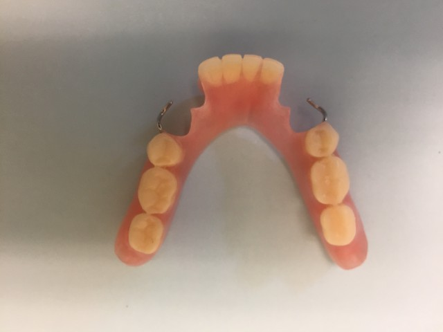 Acrylic Partial Denture
