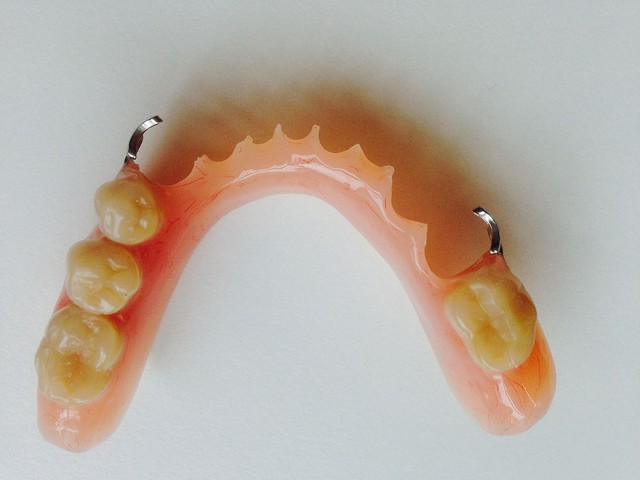 Acrylic Partial Denture