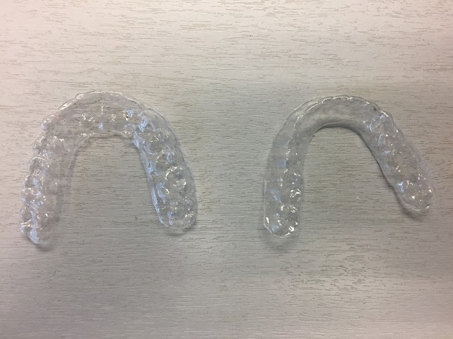 aligners