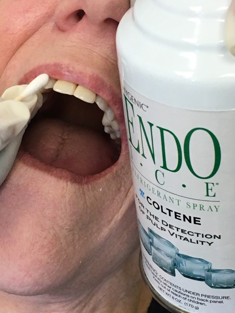 Endo Ice Test