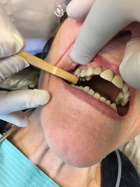 Tooth Slot Test 