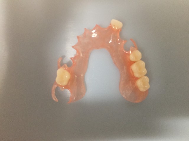 dental acrylic 