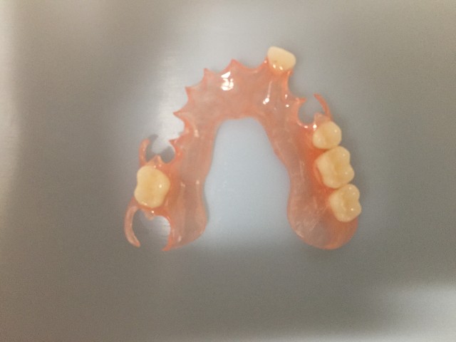 Acrylic Partial Denture