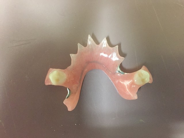 Acrylic Partial Denture 