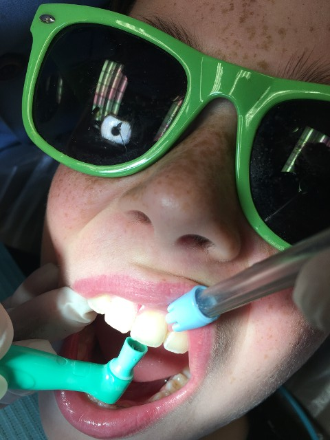 Children Teeth Cleaning
