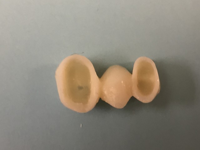 3 unit bridge