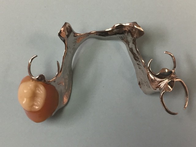 Partial Denture