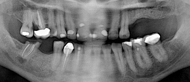 panoramic x-ray panoramic x-ray