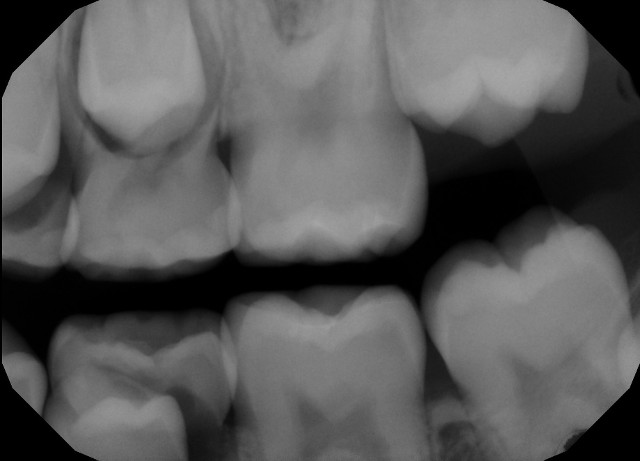 Inwood Dental PC
