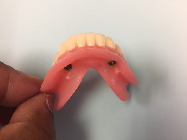 denture