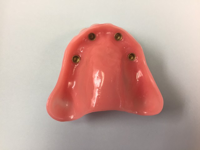 Dentures