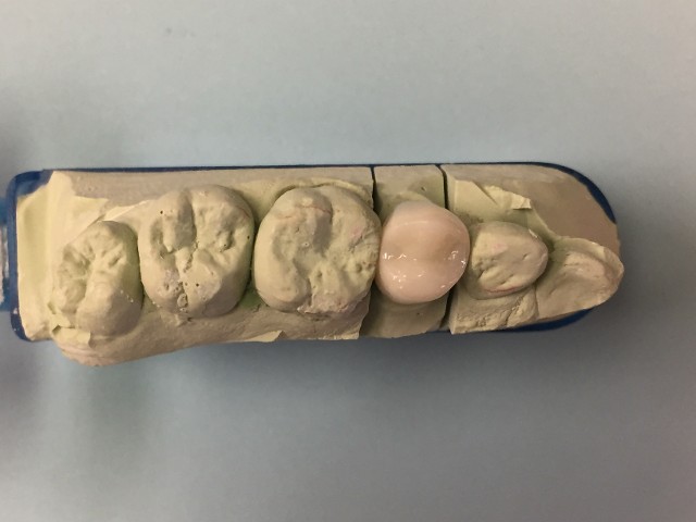 premolar crown