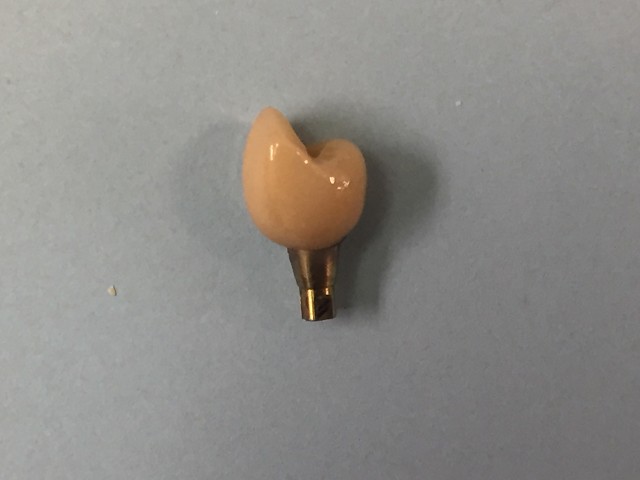 Implant crown
