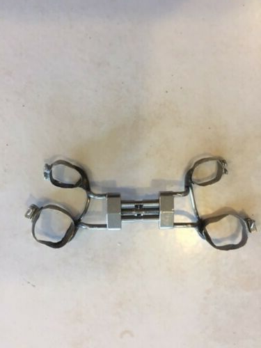 rapid palatal expander