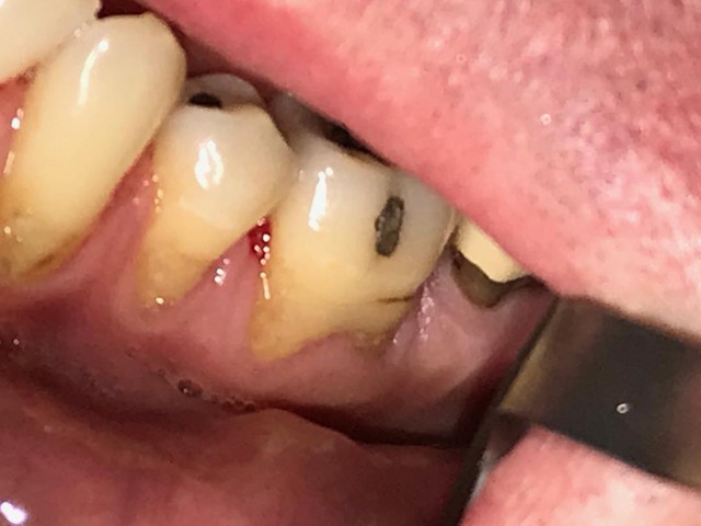 Inwood Dental PC