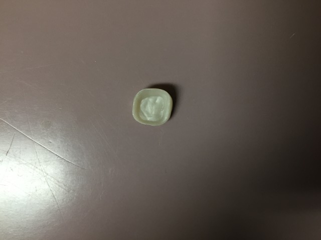 zirconia crown
