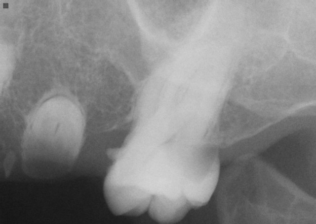 root tip