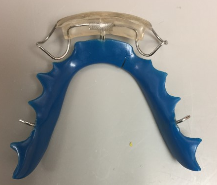 retainer