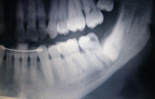 radiograph