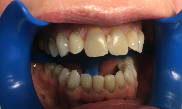 intraoral image