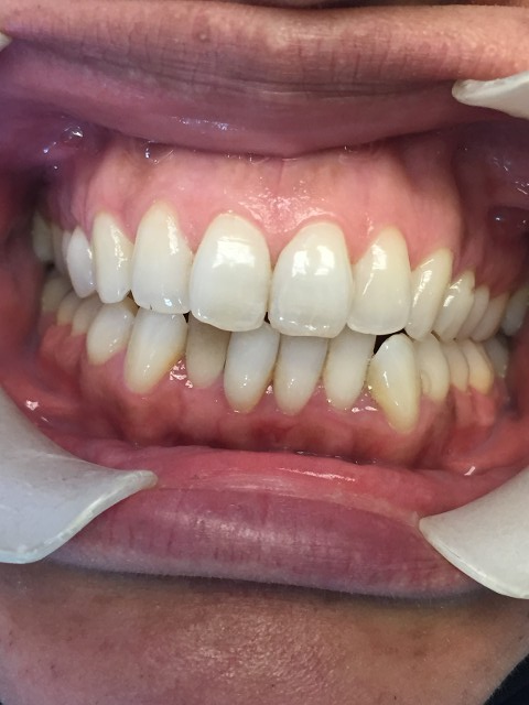 intraoral image