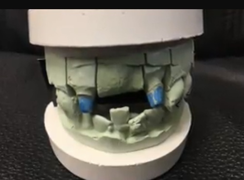 bridge model