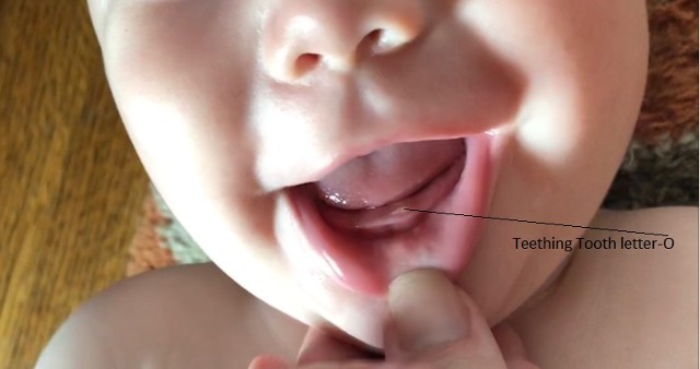 teething