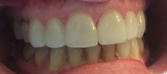 after 