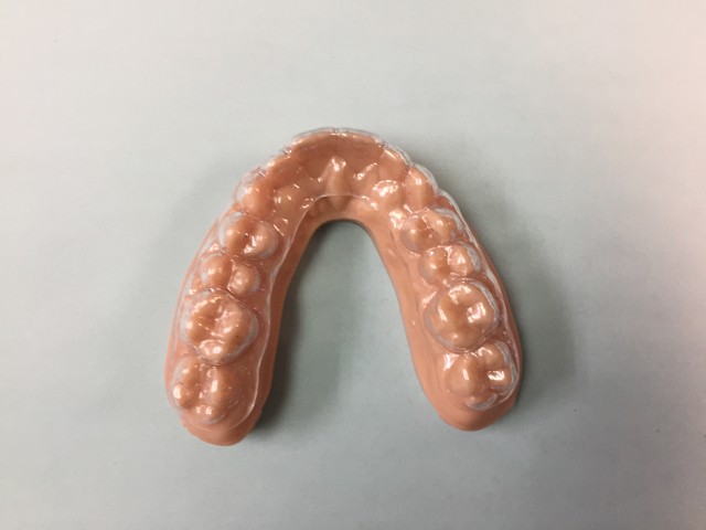 aligners