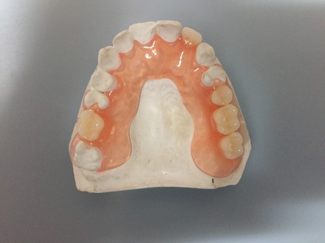 partial denture