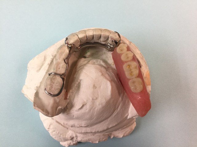 partial denture