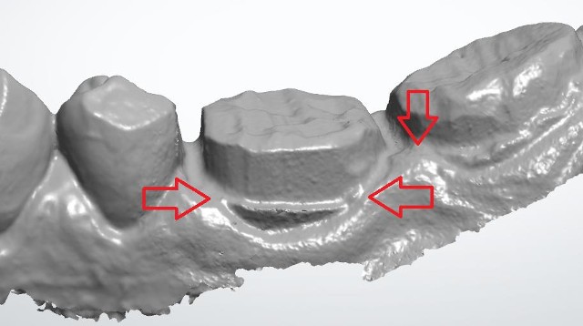 3M scanner