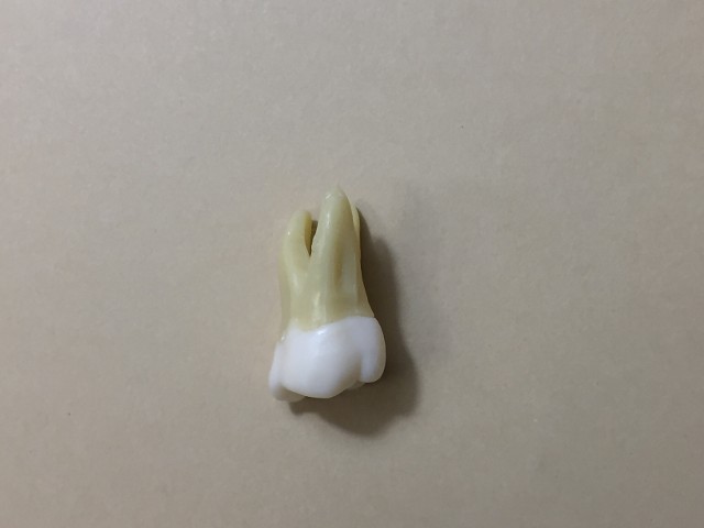 1st molar