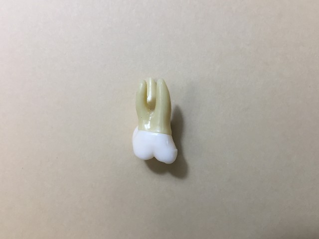 2nd molar
