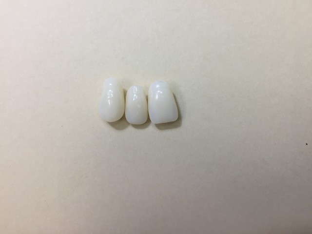 3 unit bridge