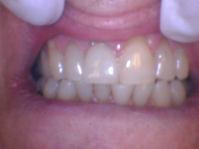 crown