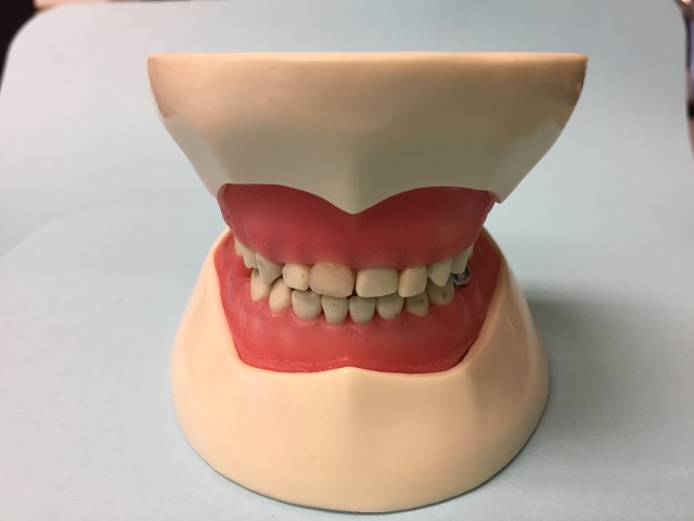 baby teeth 