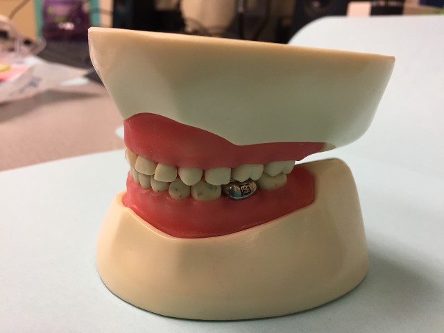 baby teeth 2