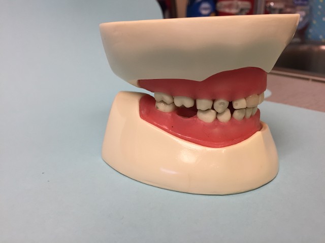 baby teeth 3